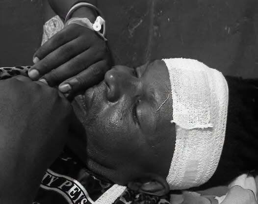 Treka Man Reportedly Injured in Alleged Robbery Attack Treka Man